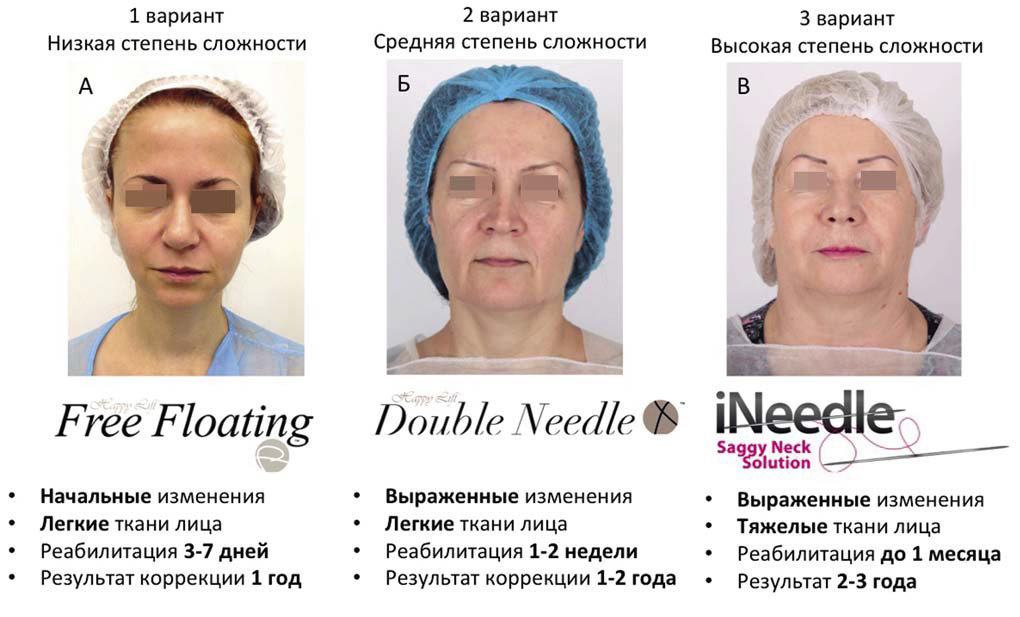 Три варианта коррекции овала лица: низкая (А), средняя (Б) и высокая (В) степень сложности